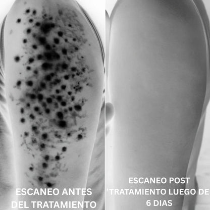 Aceite de Orégano - Lo que tu dermatólogo no te explicó (y probablemente no te va a decir) sobre por qué tus brotes en la piel siempre vuelven