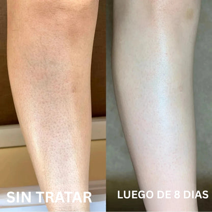 Aceite de Orégano - Lo que tu dermatólogo no te explicó (y probablemente no te va a decir) sobre por qué tus brotes en la piel siempre vuelven
